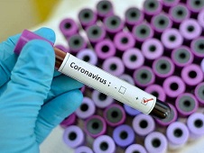 Pray for a speedy recovery from Coronavirus